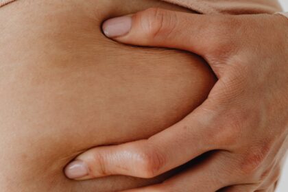 elulite: entenda as causas, os tipos e descubra como reduzir sua aparência com alimentação saudável, exercícios físicos, hidratação e hábitos que promovem uma pele mais firme e saudável.